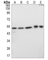 Anti-CD1a Antibody