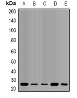 Anti-QDPR Antibody