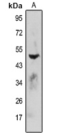 Anti-FDPS Antibody