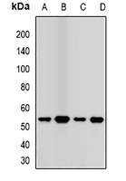 Anti-Transcobalamin-2 Antibody