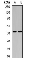 Anti-PCGF6 Antibody