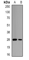 Anti-GSTO2 Antibody