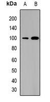 Anti-SATB1 Antibody