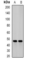 Anti-JMJD6 Antibody