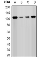 Anti-PHC1 Antibody