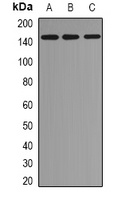 Anti-EMSY Antibody