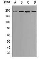 Anti-ESET Antibody