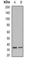 Anti-SET Antibody
