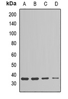 Anti-ESD Antibody