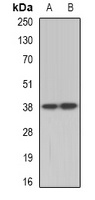 Anti-TEL2 Antibody