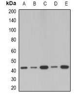 Anti-SerpinB1 Antibody
