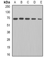 Anti-PDC-E2 Antibody