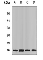 Anti-Neurokinin B Antibody