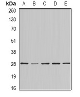 Anti-BAP29 Antibody