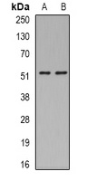 Anti-ASL Antibody
