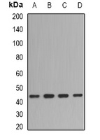 Anti-Fibromodulin Antibody