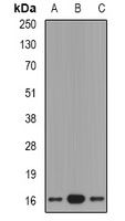 Anti-GRP Antibody