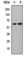 Anti-MGAT1 Antibody