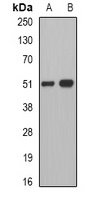 Anti-Pancreatic Lipase Antibody