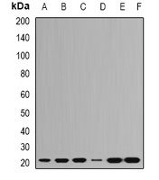 Anti-RPL9 Antibody