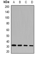 Anti-SNRPA Antibody
