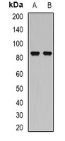 SSRP1 antibody