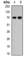 Anti-Secretogranin-2 Antibody