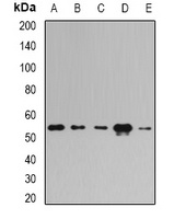 Anti-E3BP Antibody