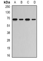 Anti-RNGTT Antibody