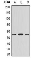 Anti-Myotilin Antibody