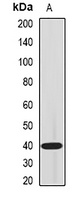 Anti-IL-18BP Antibody
