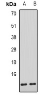 Anti-AHSP Antibody