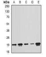 Anti-PTRH2 Antibody