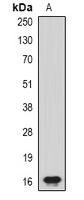 Anti-CHRAC17 Antibody