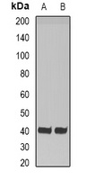 HAO1 antibody