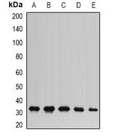 Anti-AK2 Antibody