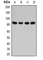 Anti-CARS Antibody
