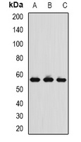 Anti-TCP1-delta Antibody