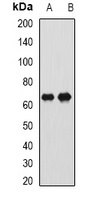 Anti-CTNNBL1 Antibody