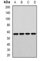 DARS antibody