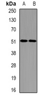 Anti-eIF2S3 Antibody