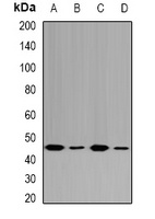 Anti-Fumarylacetoacetase Antibody