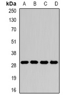 Anti-GAMT Antibody