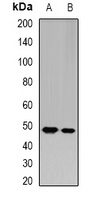 GATM antibody