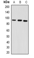 Anti-GPAM Antibody