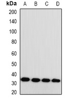 Anti-Monoglyceride Lipase Antibody