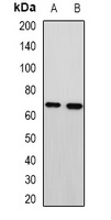 Anti-MTA3 Antibody