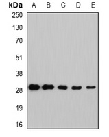 Anti-NNMT Antibody