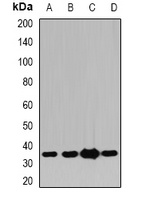 PDXK antibody