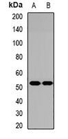 Anti-ADPN Antibody